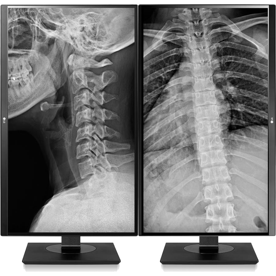 Moniteur ACL UHD 4K 27 po LG 27HJ713C-B - Blanc 27HJ713C-B