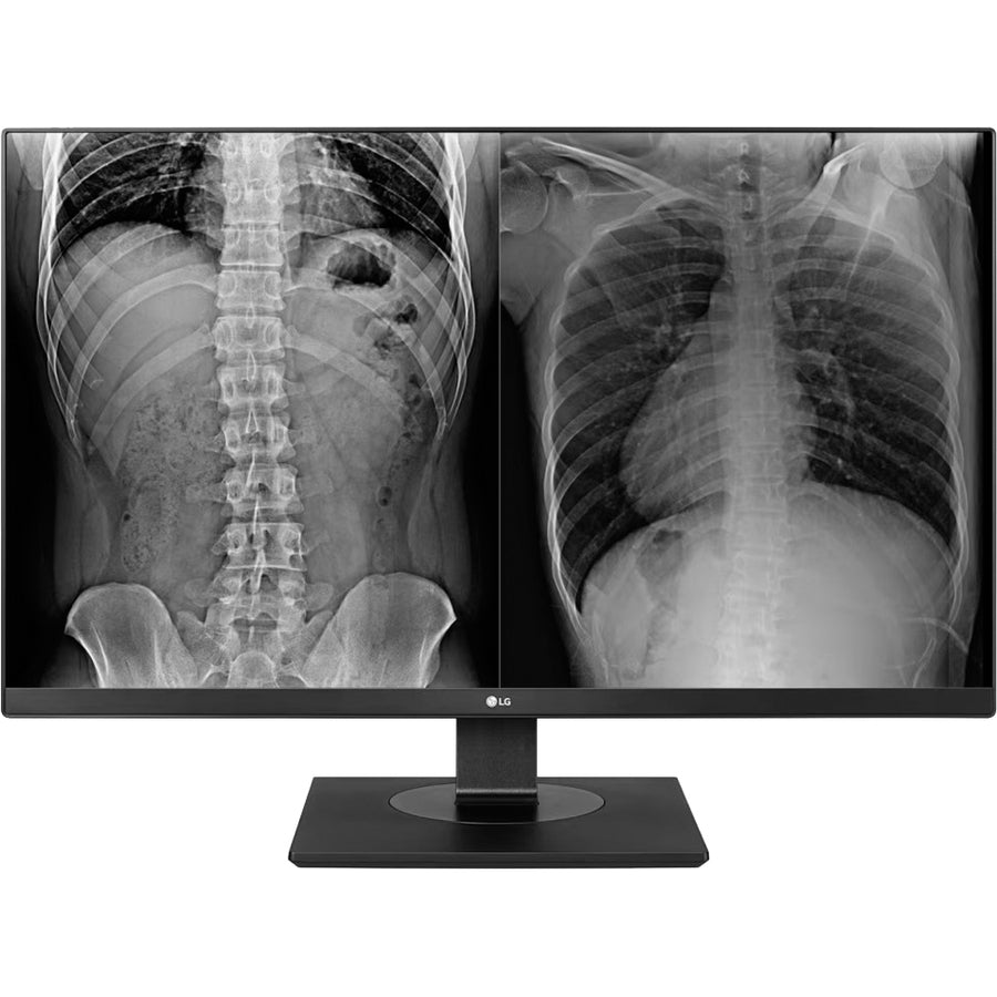 Moniteur ACL UHD 4K 27 po LG 27HJ713C-B - Blanc 27HJ713C-B